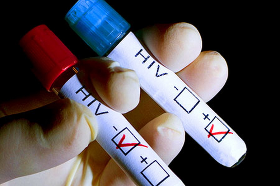 hiv test tube aids