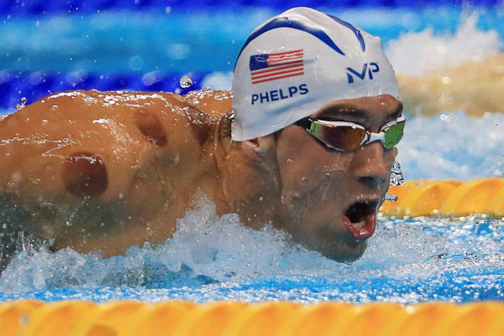phelps-cupping 2