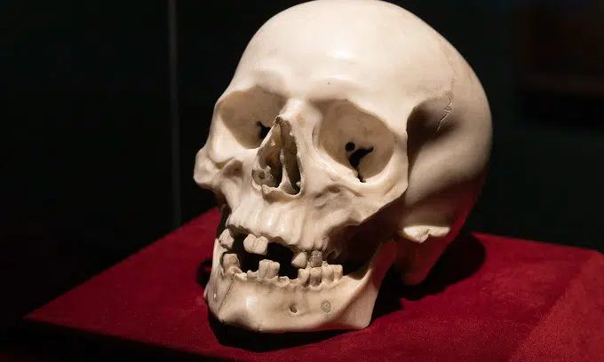 Bernini skull