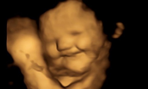 Ultrasound of human fetus.
