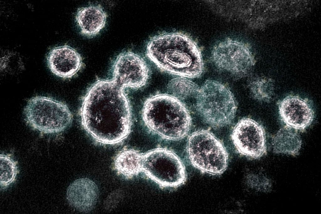 SARS-CoV-2 Virus that causes COVID19