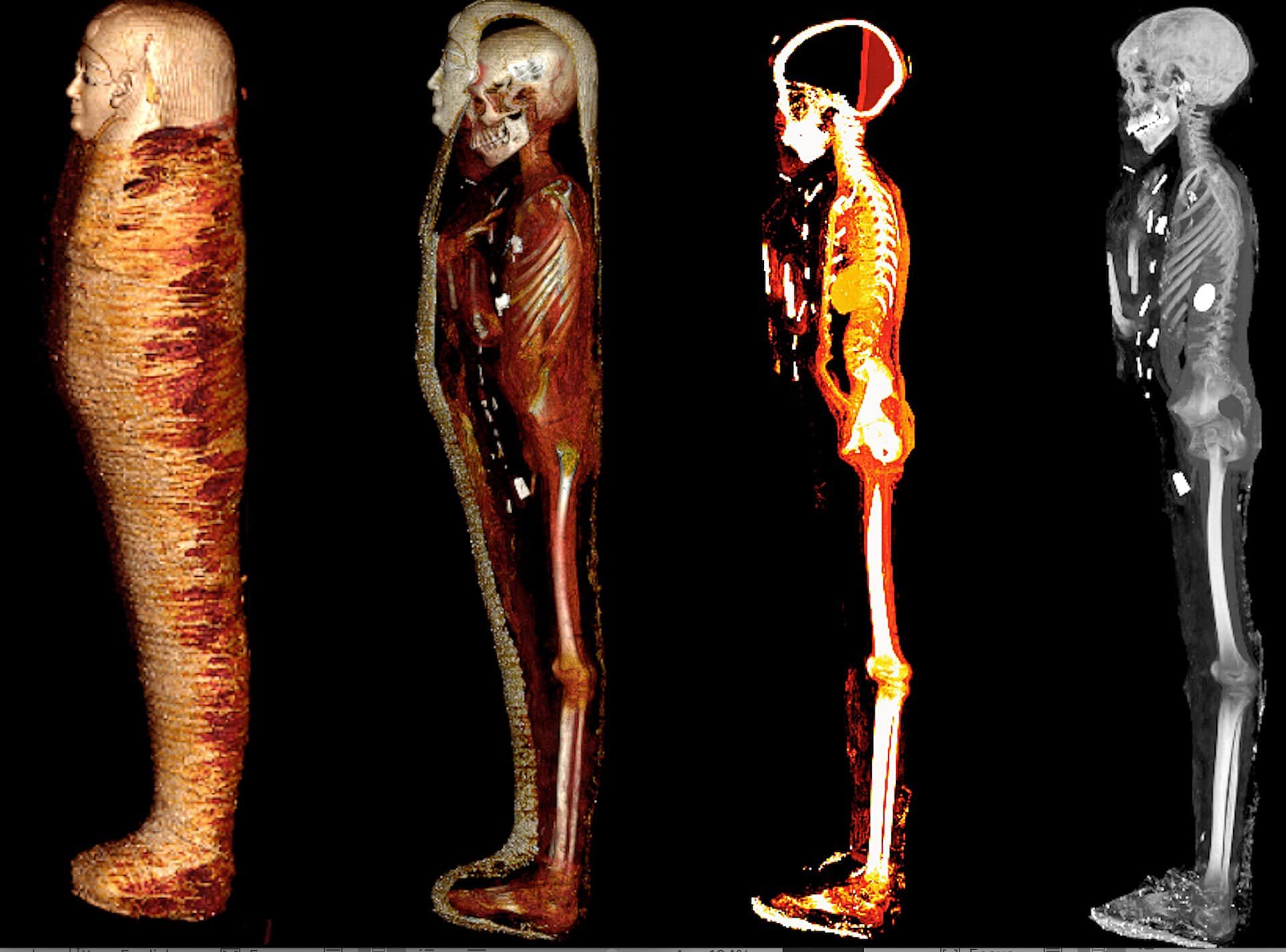 golden child mummy scan egypt