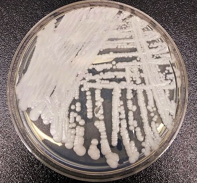CDC reports increase in the spread of deadly Candida auris fungus in USA