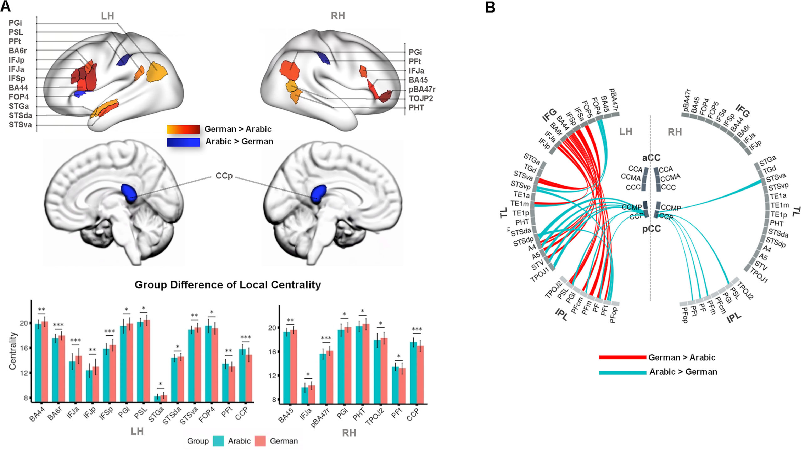 diagram brain connectivity and native language 