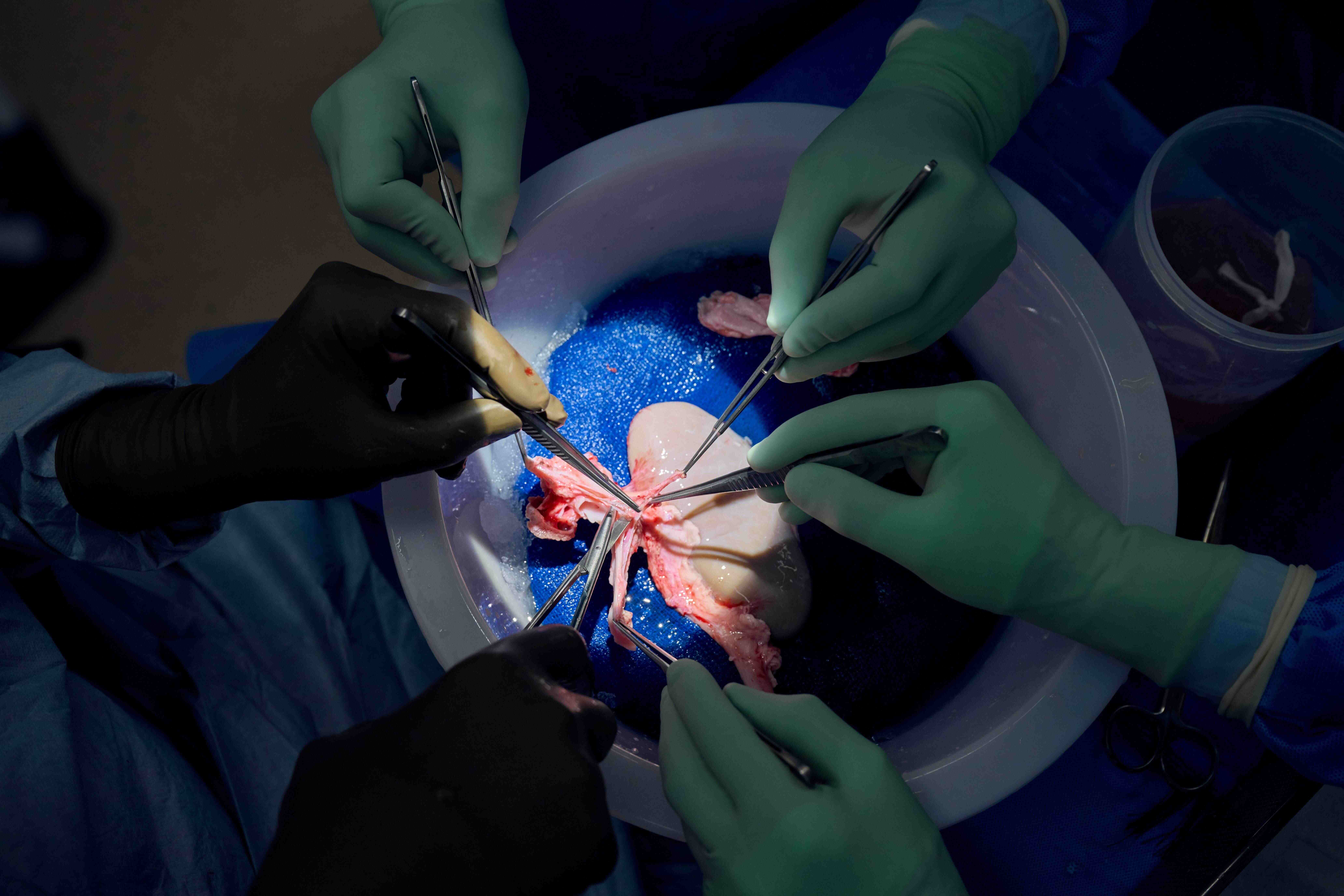 Tissue from the pig kidney is examined and removed in preparation for transplant. Credit: Joe Carrotta for NYU Langone Health