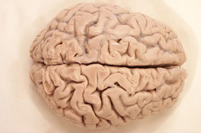 New Study Challenges Beliefs on Human Brain Preservation