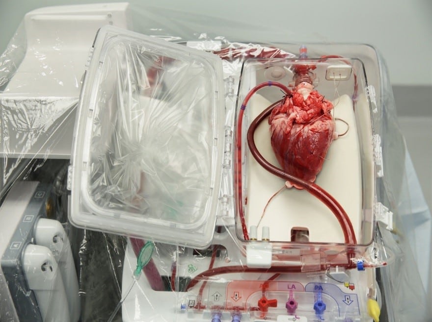 Beating heart awaiting transplantation