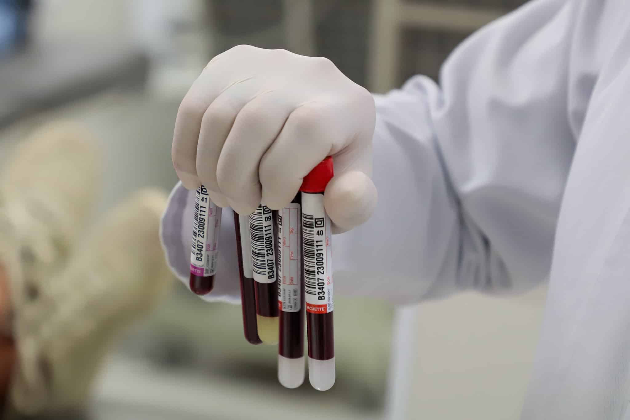 Scientists Discover a Completely New Blood Type