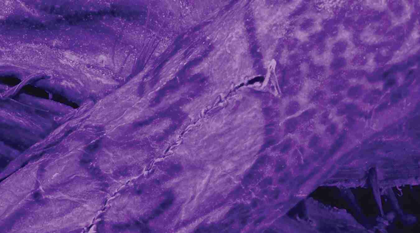 Post-mortem sutured skin cuts through the images indicate the tattoos