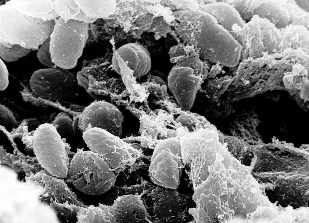 Mass of Yersinia pestis under scanning electron microscope