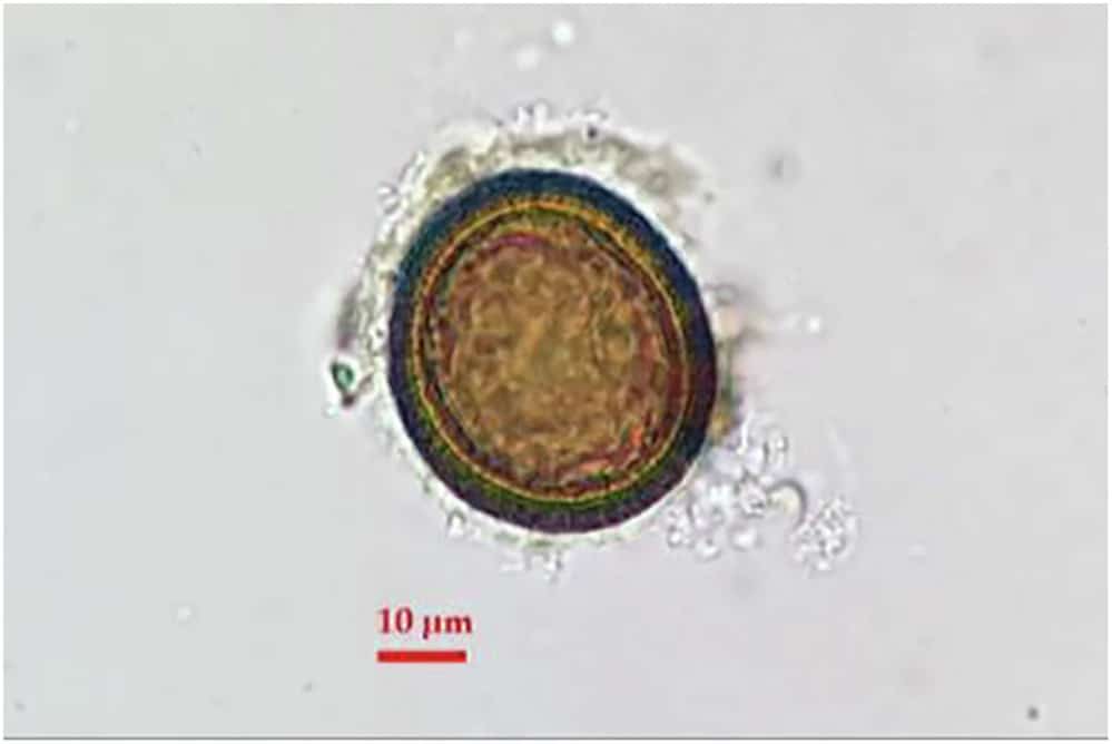 Egg of Taenia sp. recovered at Novae