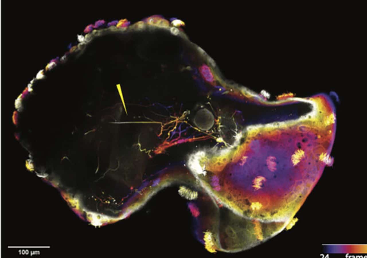 Neurobot with living nervous system