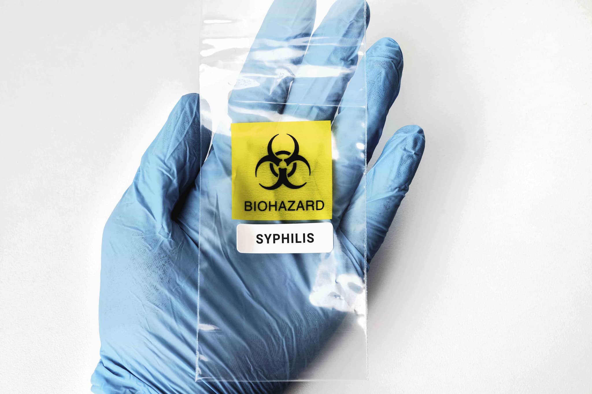 Syphilis