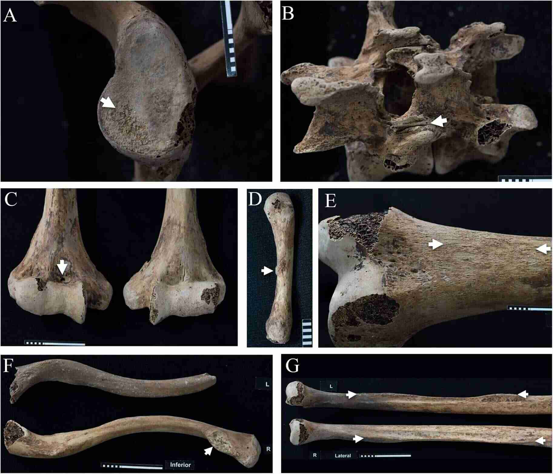 Ancient remains of Princess Ita of Egypt