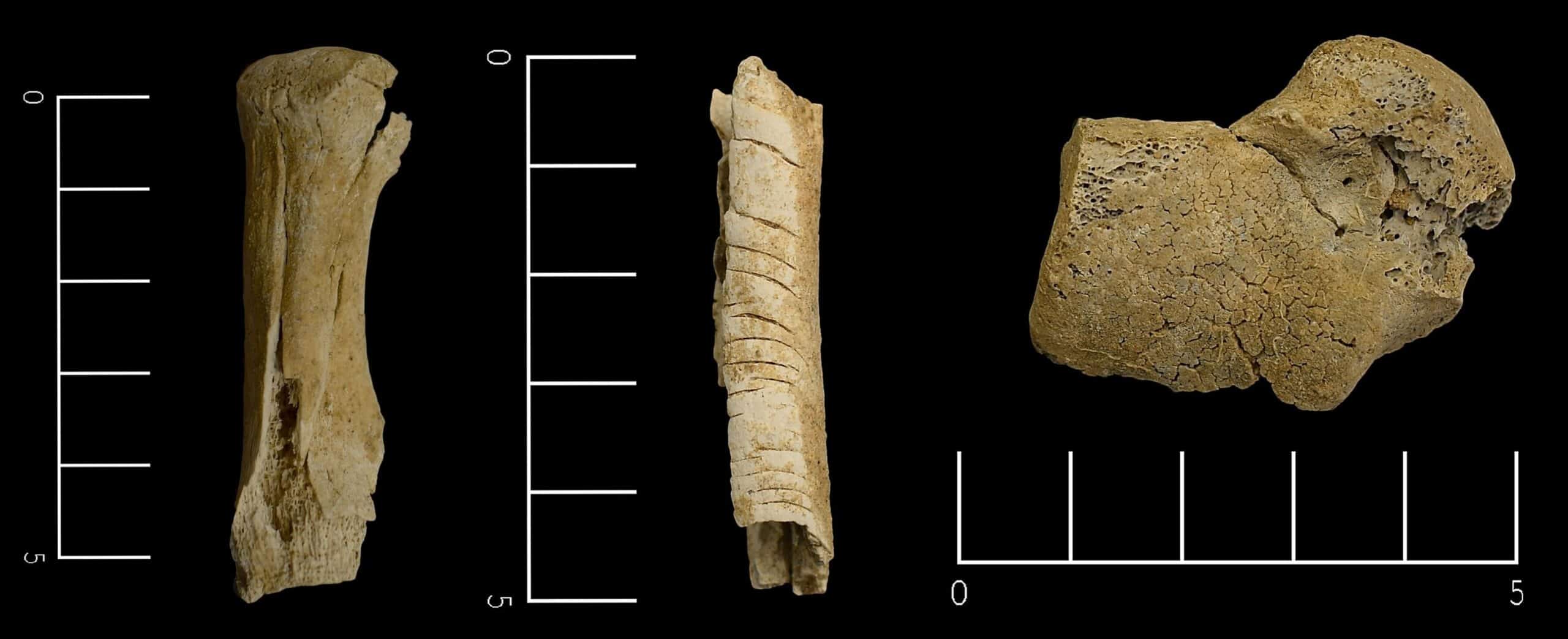 Bone fragments from Polichni and Nea Philadelphia with fractures