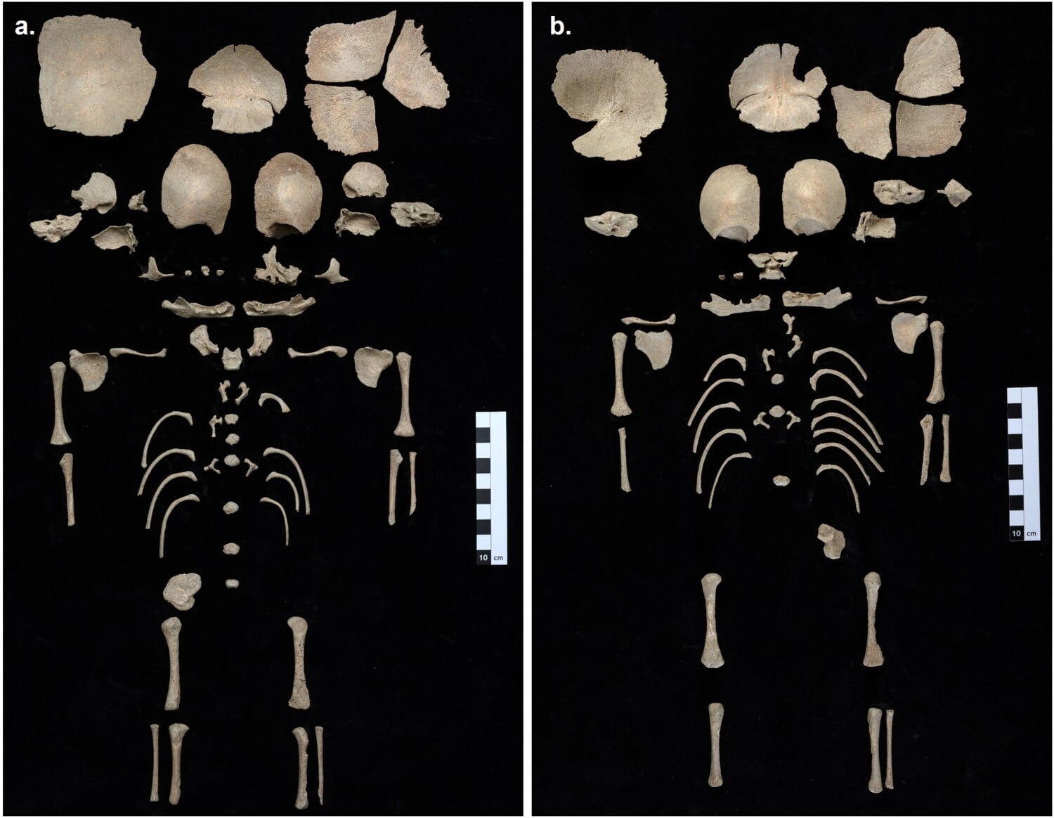 Reconstructed skeletal remains of the two perinatal infants discovered in a carefully built brick-lined grave at Ephesus